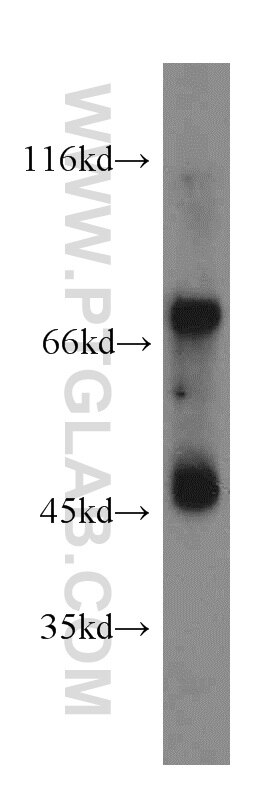 Western Blot (WB) analysis of Apoptosised HeLa cells using IVNS1ABP Polyclonal antibody (14741-1-AP)