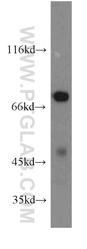 Western Blot (WB) analysis of mouse heart tissue using IVNS1ABP Polyclonal antibody (14741-1-AP)