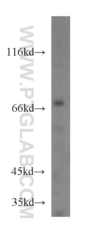 Western Blot (WB) analysis of mouse ovary tissue using IVNS1ABP Polyclonal antibody (14741-1-AP)