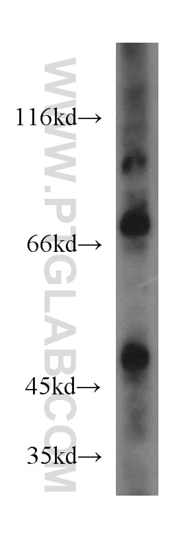 Western Blot (WB) analysis of mouse ovary tissue using IVNS1ABP Polyclonal antibody (14741-1-AP)