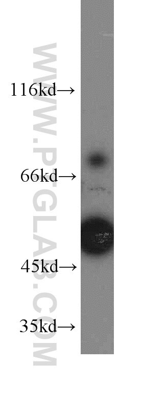 WB analysis of K-562 using 14741-1-AP