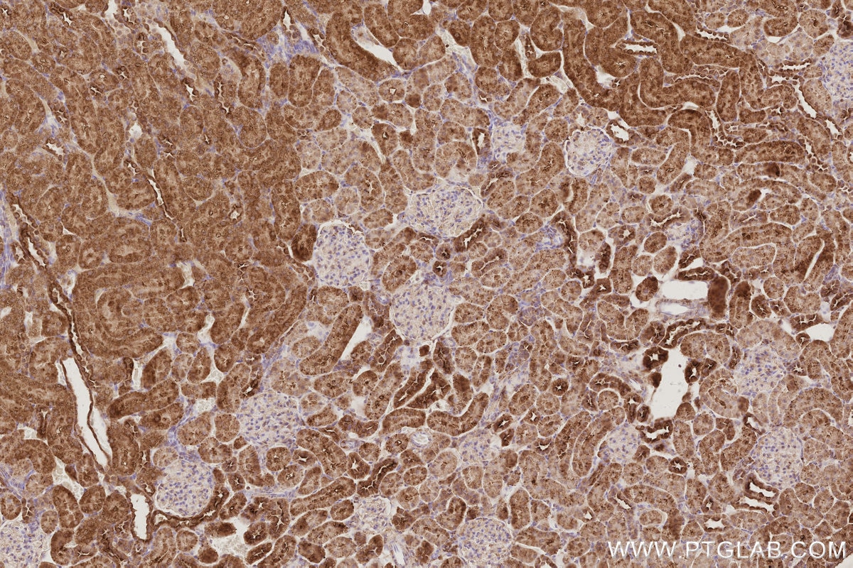 IHC staining of rat kidney using 84268-1-RR Immunohistochemistry (IHC) staining of rat kidney tissue using IVNS1ABP Recombinant monoclonal antibody (84268-1-RR)