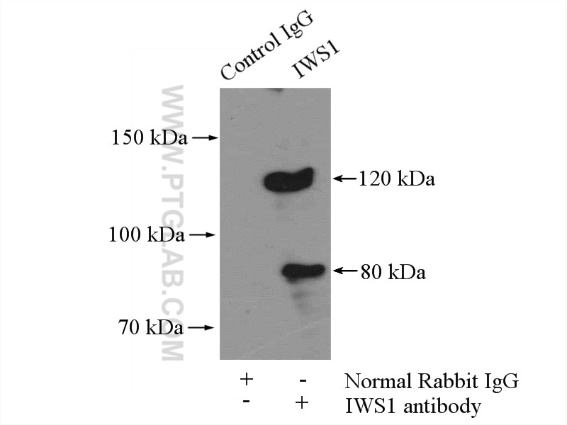 Immunoprecipitation (IP) experiment of mouse brain tissue using IWS1 Polyclonal antibody (16943-1-AP)