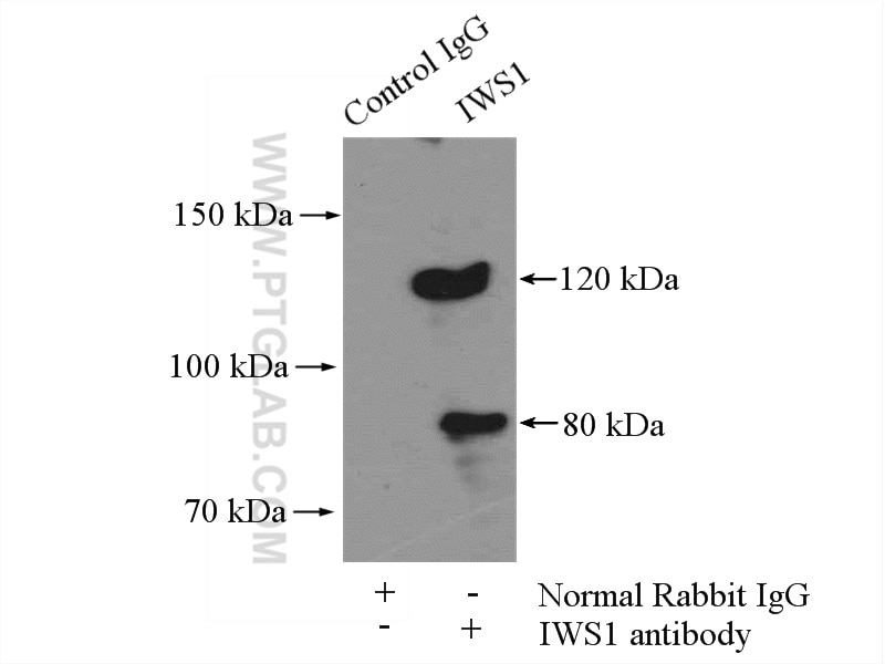 IP experiment of mouse brain using 16943-1-AP