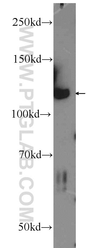 Western Blot (WB) analysis of mouse brain tissue using IWS1 Polyclonal antibody (16943-1-AP)