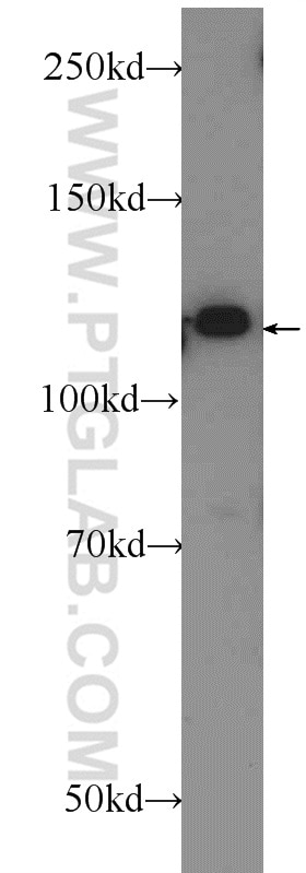 Western Blot (WB) analysis of rat brain tissue using IWS1 Polyclonal antibody (16943-1-AP)