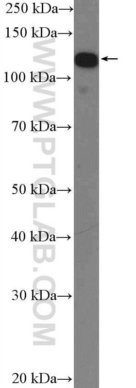 Western Blot (WB) analysis of HeLa cells using IWS1 Polyclonal antibody (16943-1-AP)