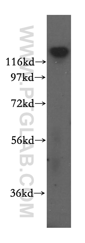 Western Blot (WB) analysis of human brain tissue using IWS1 Polyclonal antibody (16943-1-AP)