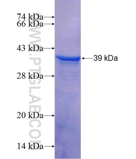 IWS1 fusion protein Ag10649 SDS-PAGE