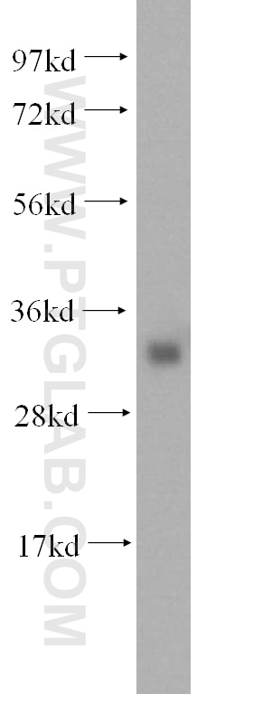 Western Blot (WB) analysis of human liver tissue using IYD Polyclonal antibody (16667-1-AP)