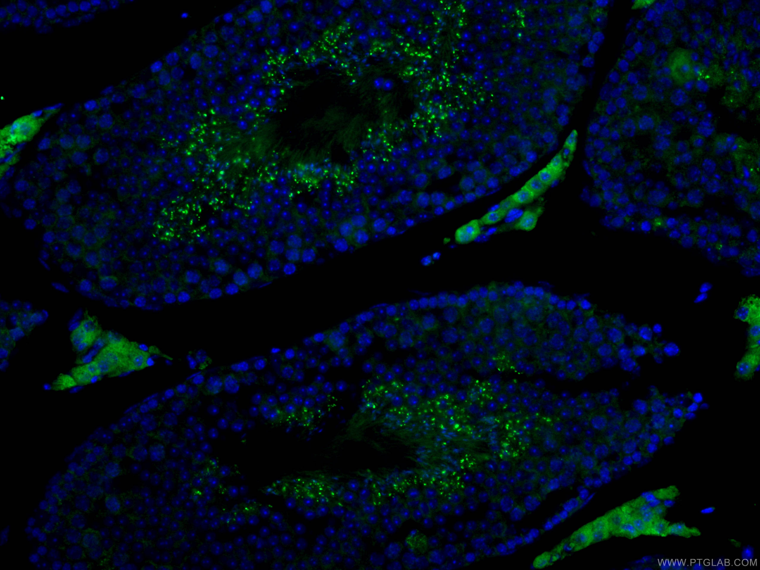 IF Staining of mouse testis using 13296-1-AP