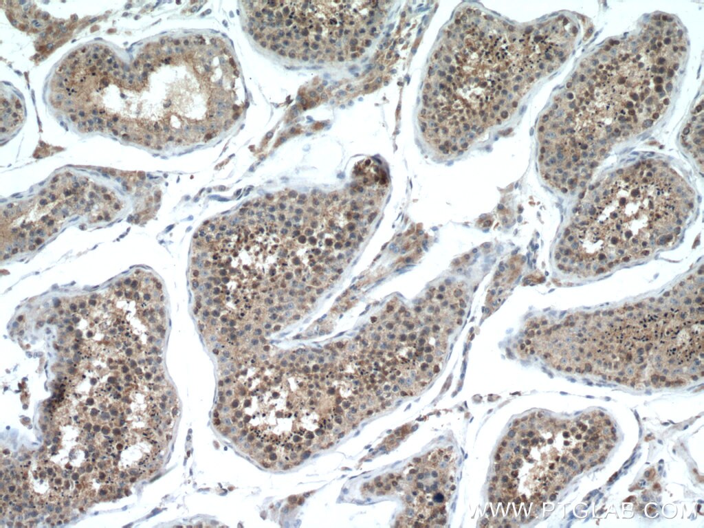 Immunohistochemistry (IHC) staining of human testis tissue using IZUMO1 Polyclonal antibody (13296-1-AP)
