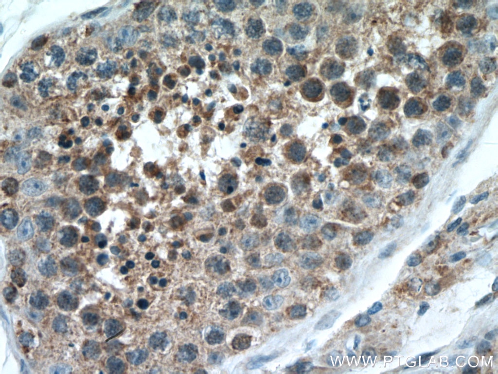 Immunohistochemistry (IHC) staining of human testis tissue using IZUMO1 Polyclonal antibody (13296-1-AP)