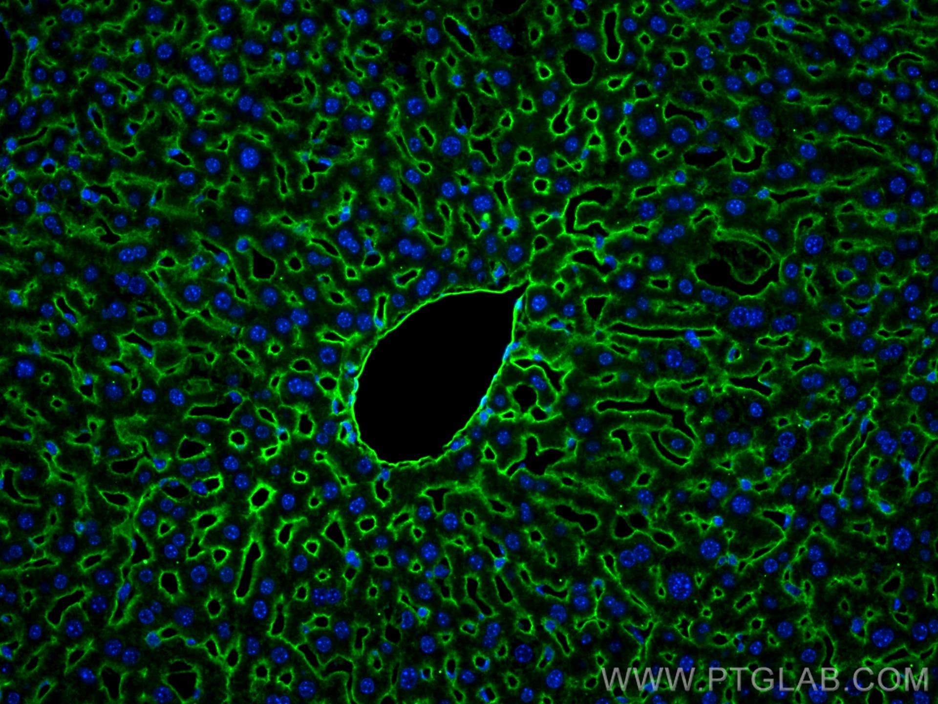 Immunofluorescence (IF) / fluorescent staining of mouse liver tissue using Icam-1 Polyclonal antibody (30324-1-AP)