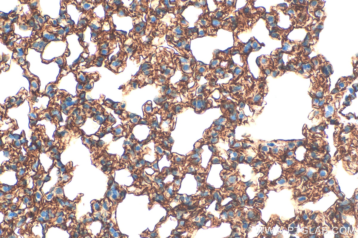 Immunohistochemistry (IHC) staining of mouse lung tissue using Icam-1 Polyclonal antibody (30324-1-AP)