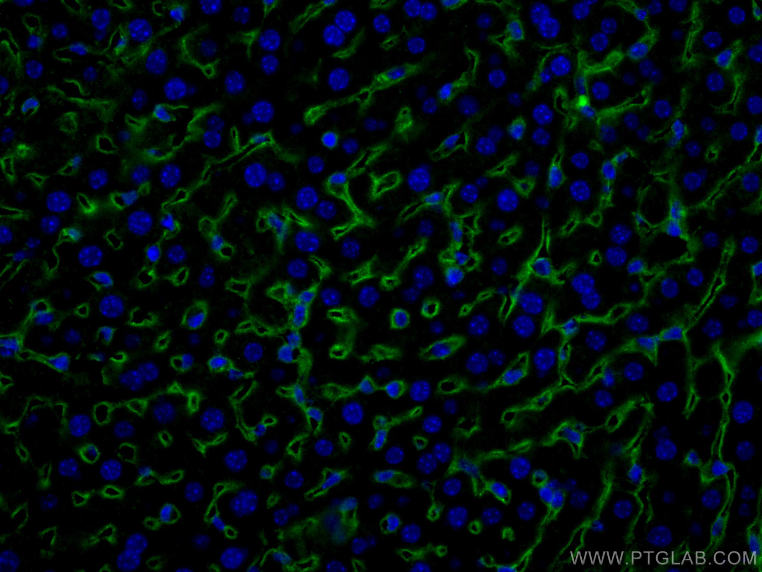Immunofluorescence (IF) / fluorescent staining of mouse liver tissue using Icam-1 Polyclonal antibody (10020-1-AP)
