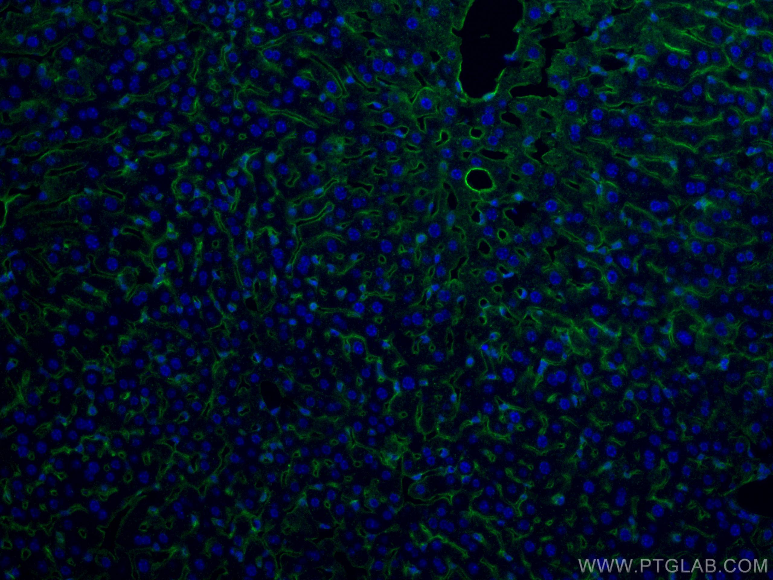 Immunofluorescence (IF) / fluorescent staining of mouse liver tissue using Icam-1 Polyclonal antibody (10020-1-AP)