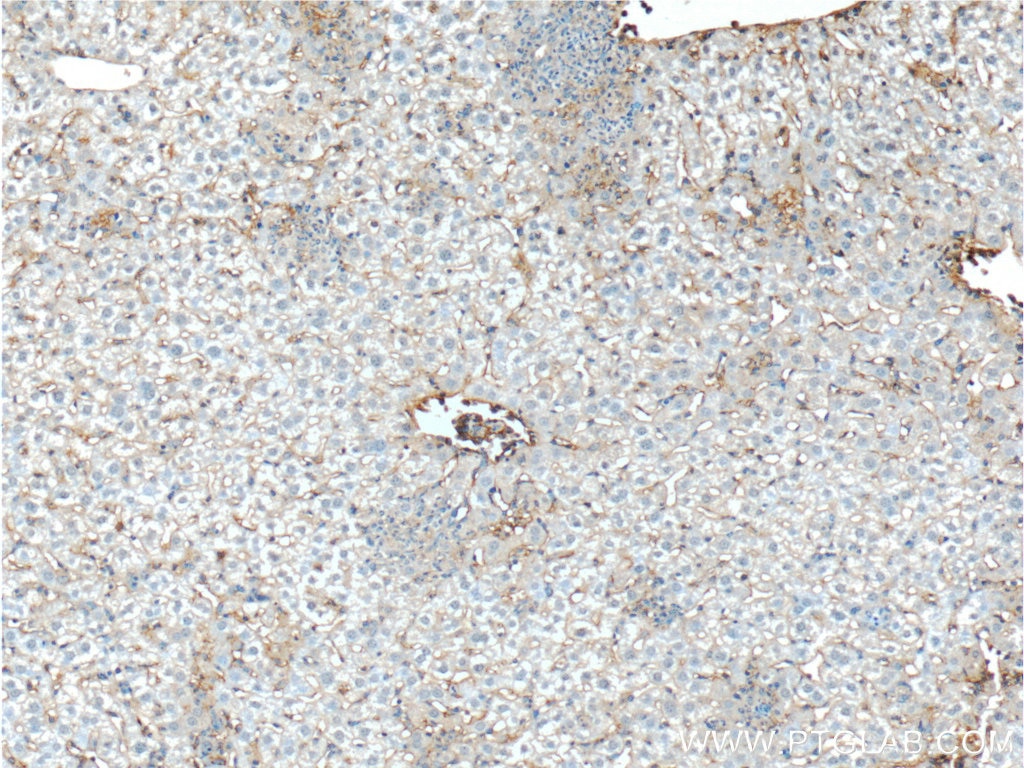 Immunohistochemistry (IHC) staining of mouse liver tissue using Icam-1 Polyclonal antibody (10020-1-AP)