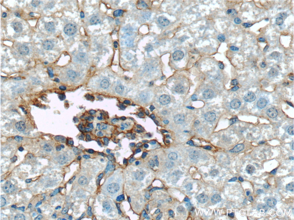 Immunohistochemistry (IHC) staining of mouse liver tissue using Icam-1 Polyclonal antibody (10020-1-AP)