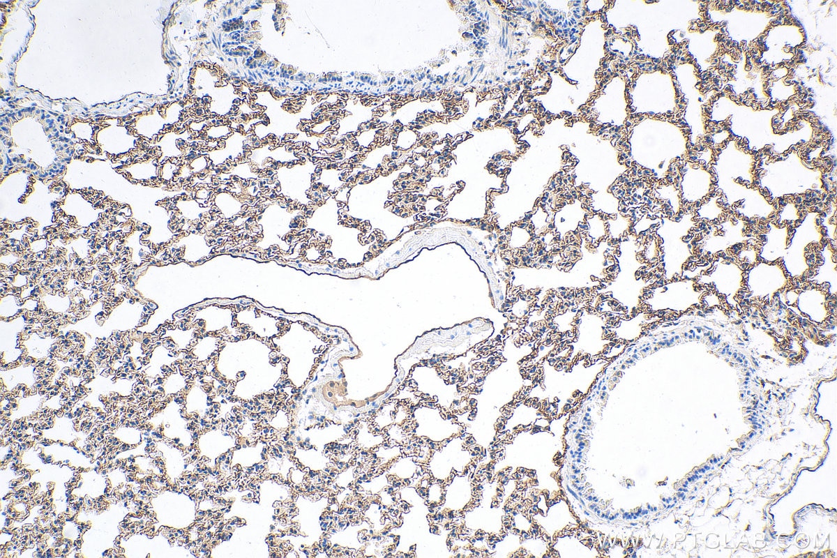 Immunohistochemistry (IHC) staining of mouse lung tissue using Icam-1 Polyclonal antibody (10020-1-AP)