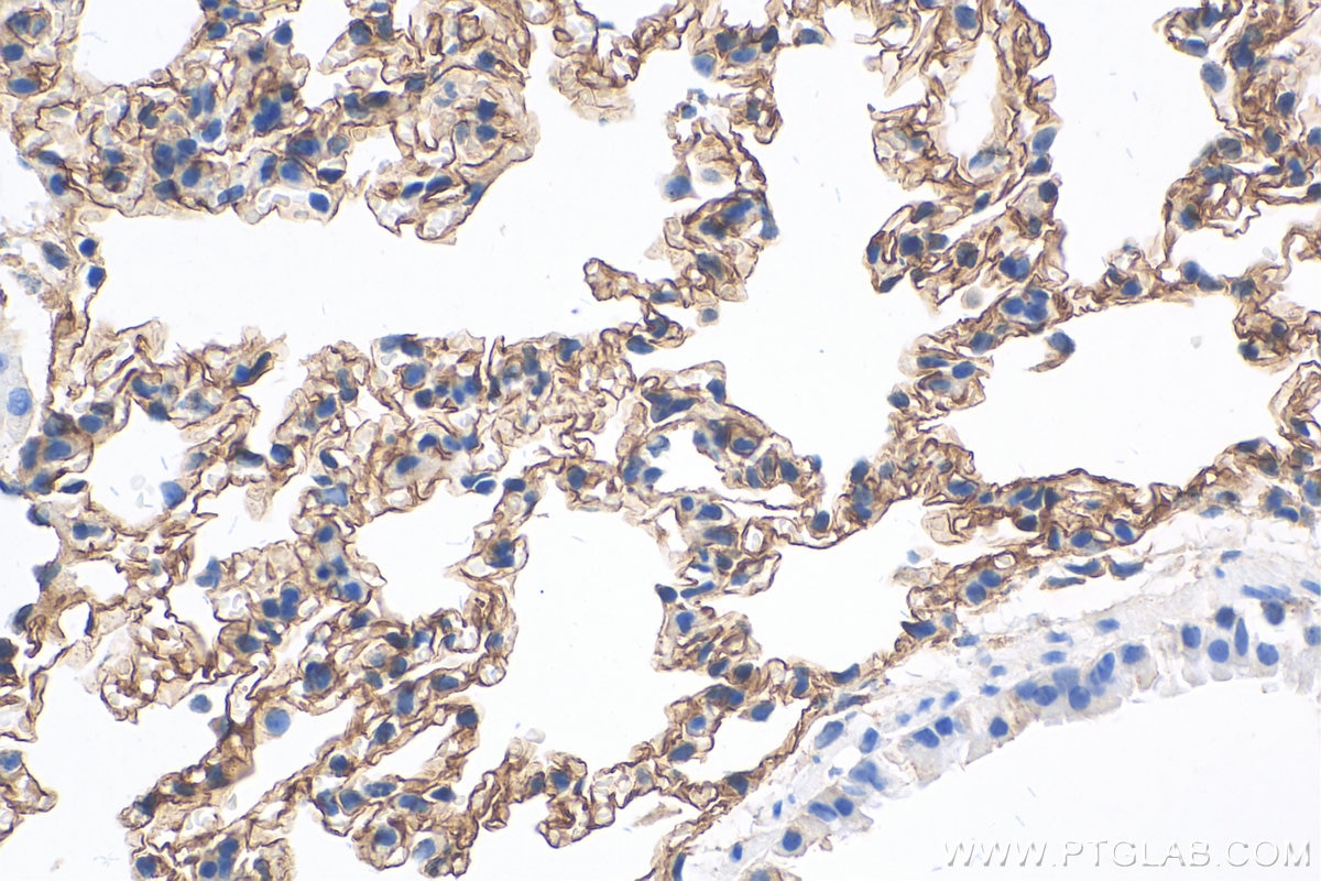 Immunohistochemistry (IHC) staining of mouse lung tissue using Icam-1 Polyclonal antibody (10020-1-AP)