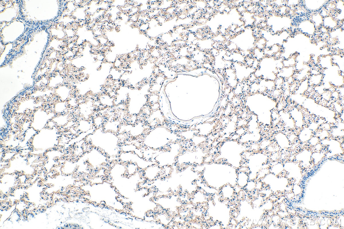 IHC staining of mouse lung using 10020-1-AP Immunohistochemistry (IHC) staining of mouse lung tissue using ICAM-1/CD54 Polyclonal antibody (10020-1-AP)