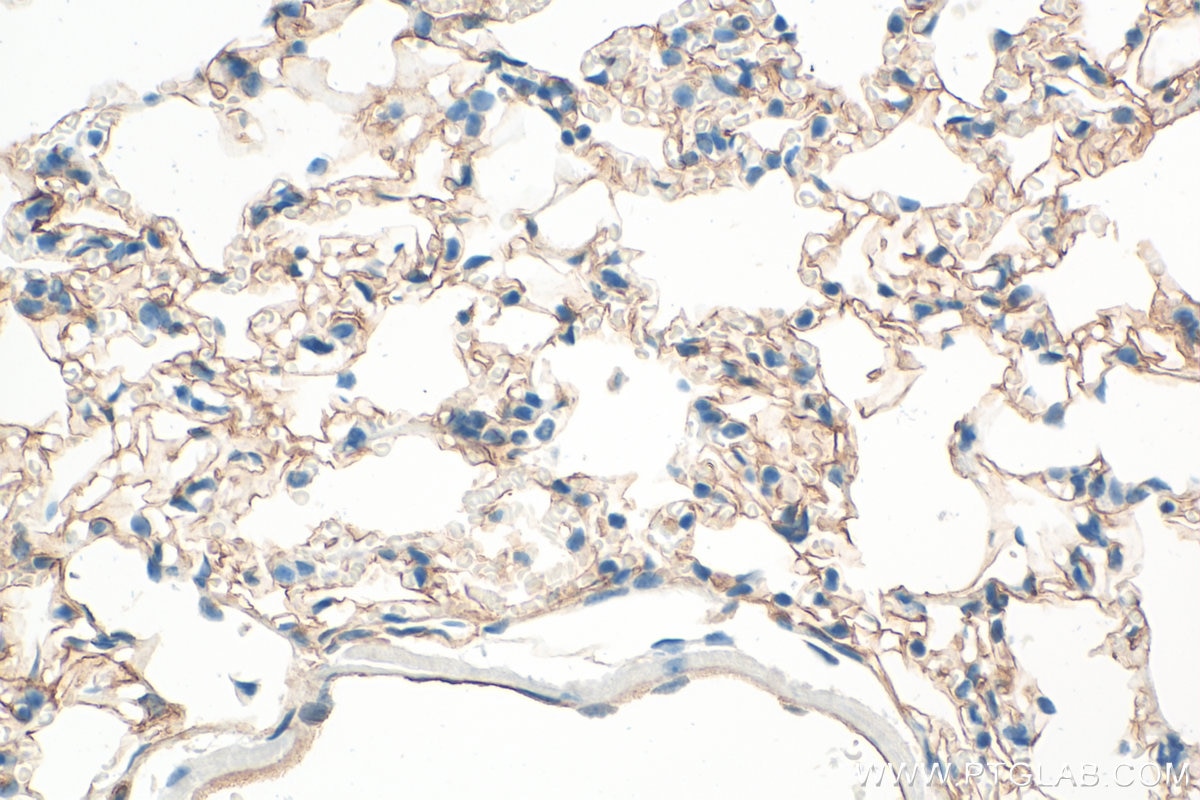IHC staining of mouse lung using 10020-1-AP Immunohistochemistry (IHC) staining of mouse lung tissue using ICAM-1/CD54 Polyclonal antibody (10020-1-AP)