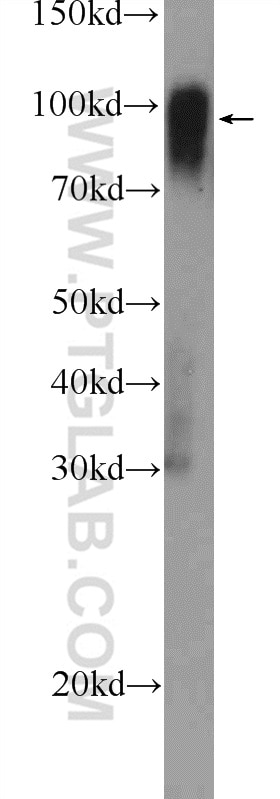 Western Blot (WB) analysis of mouse brain tissue using Icam-1 Polyclonal antibody (10020-1-AP)