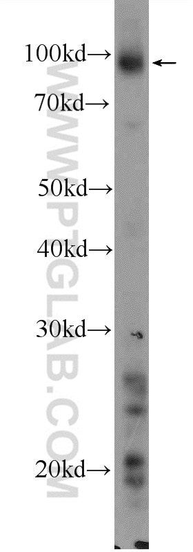 Western Blot (WB) analysis of mouse liver tissue using Icam-1 Polyclonal antibody (10020-1-AP)