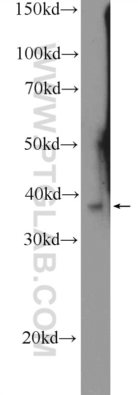 Western Blot (WB) analysis of MDCK cells using Icln Polyclonal antibody (25964-1-AP)