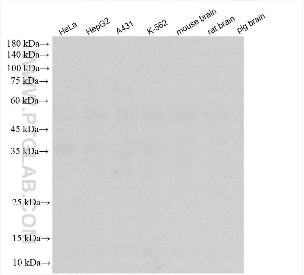 Western Blot (WB) analysis of various lysates using Rabbit IgG Isotype Control,  Rabbit Recombinant An (98136-1-RR)