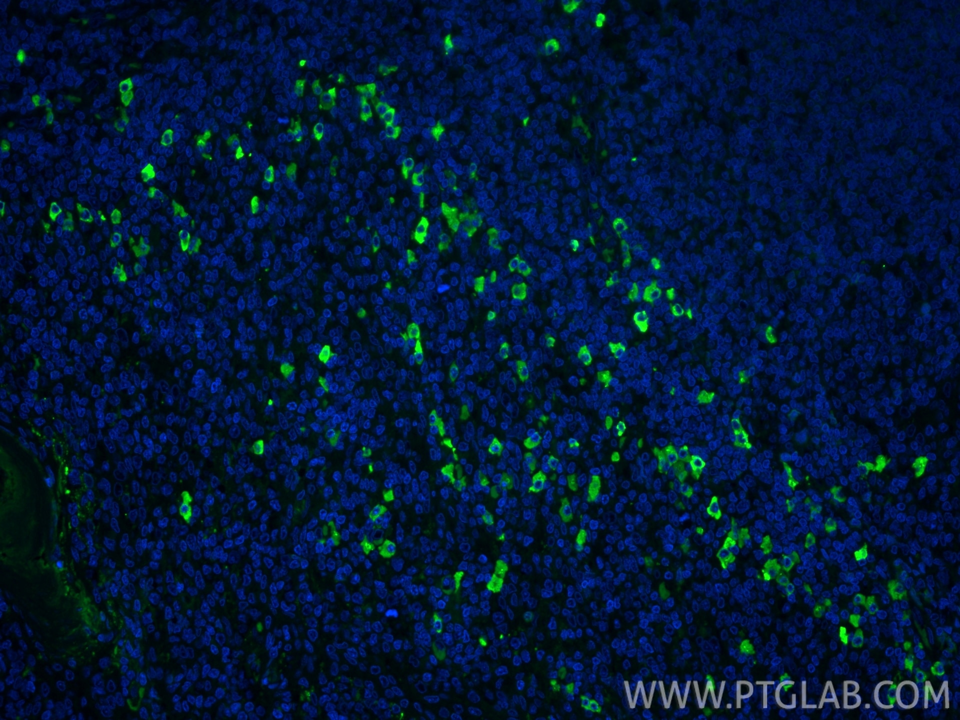 Immunofluorescent analysis of (4% PFA) fixed paraffin-embedded human tonsillitis tissue using CoraLite® Plus 488 IgG Kappa Light Chain antibody (CL488-11781) at dilution of 1:200. Heat mediated antigen retrieval with Tris-EDTA buffer (pH 9.0). Immunofluorescence (IF) / fluorescent staining of human tonsillitis tissue using CoraLite® Plus 488-conjugated IgG Kappa Light Chai (CL488-11781)