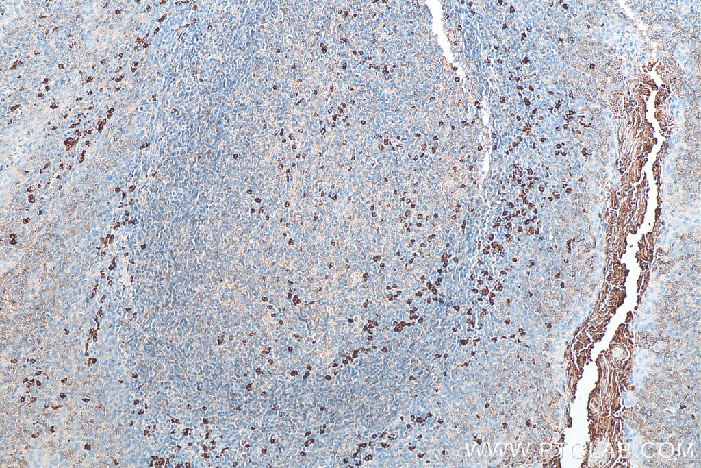 Immunohistochemistry (IHC) staining of human tonsillitis tissue using Biotin-conjugated IgG Lambda Light Chain Polyclona (Biotin-11541)