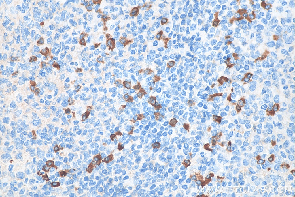Immunohistochemistry (IHC) staining of human tonsillitis tissue using Biotin-conjugated IgG Lambda Light Chain Polyclona (Biotin-20758)