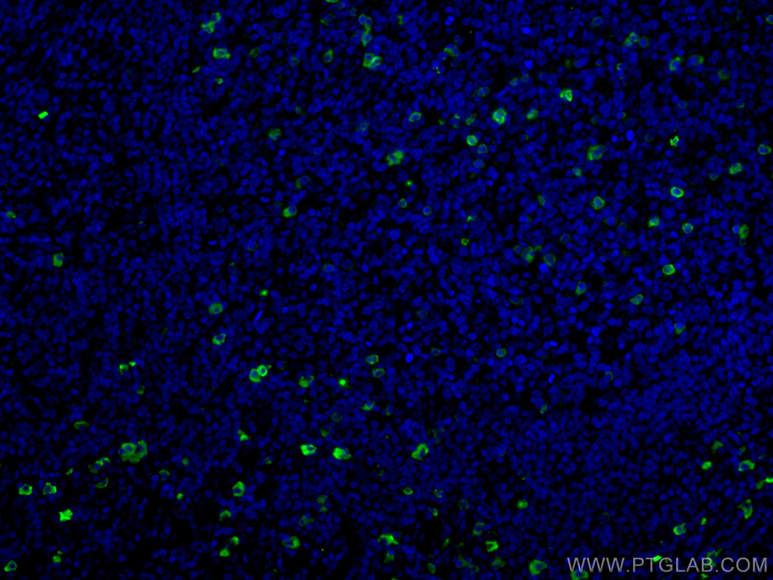 Immunofluorescence (IF) / fluorescent staining of human tonsillitis tissue using CoraLite® Plus 488-conjugated IgG Lambda Light Cha (CL488-11541)