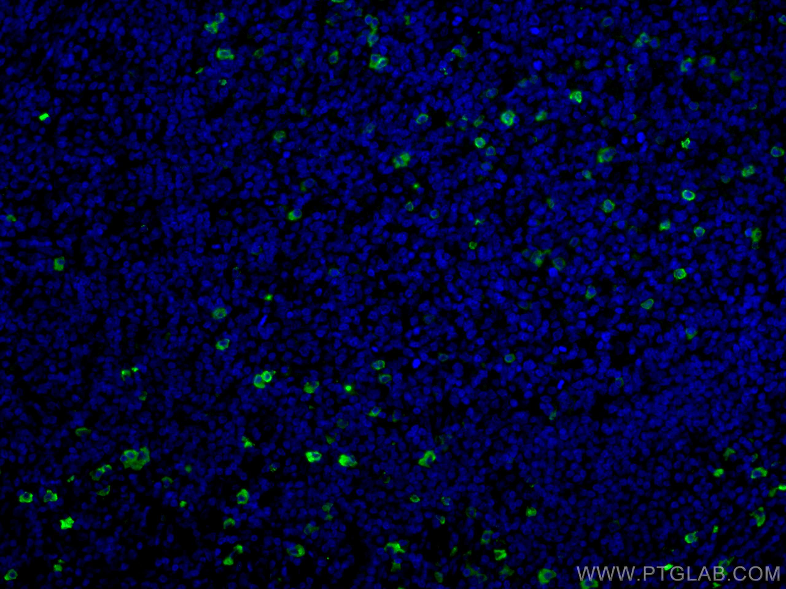 IF Staining of human tonsillitis using CL488-11541