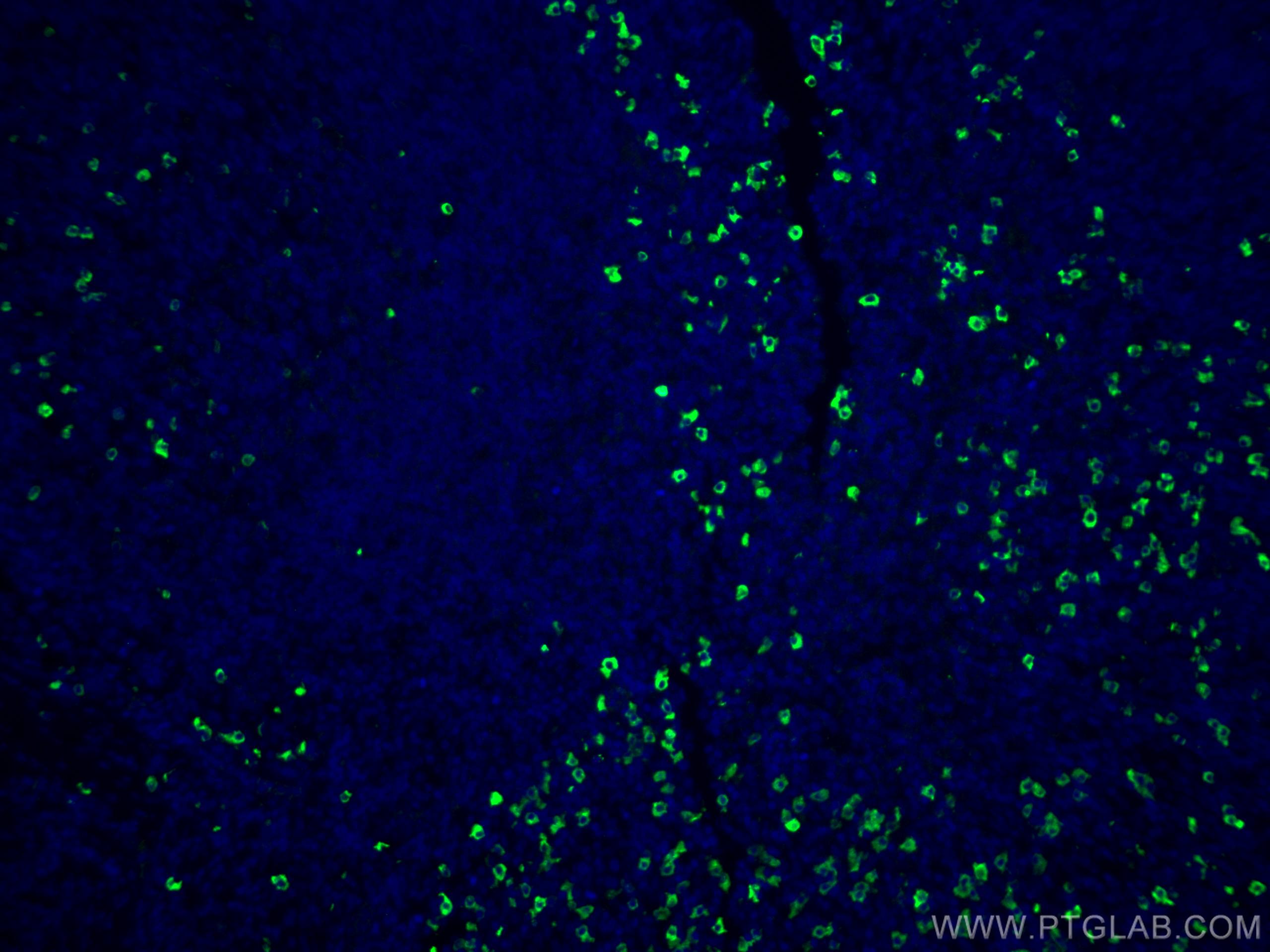 Immunofluorescence (IF) / fluorescent staining of human tonsillitis tissue using CoraLite® Plus 488-conjugated IgG Lambda Light Cha (CL488-20758)