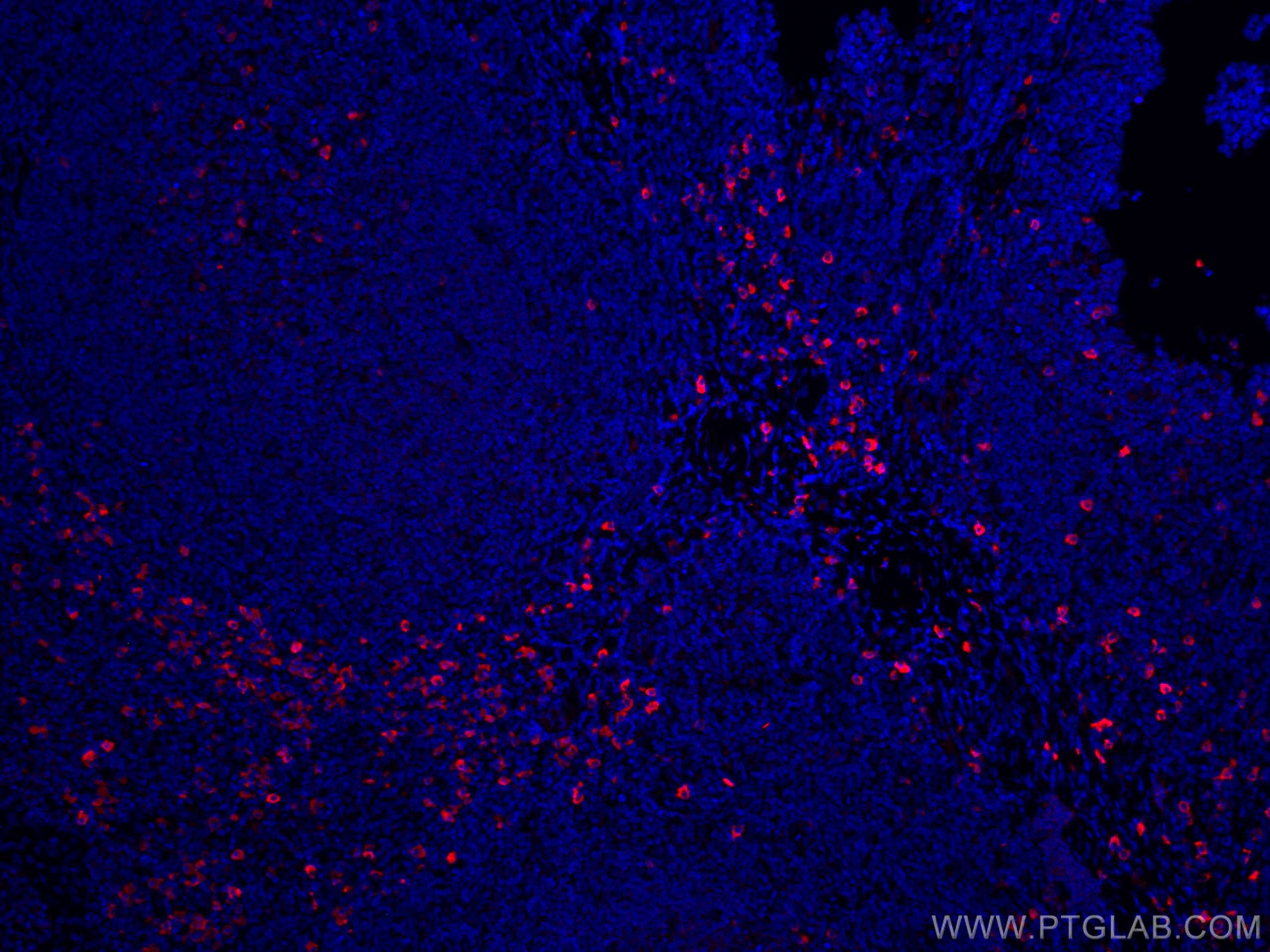 Immunofluorescence (IF) / fluorescent staining of human tonsillitis tissue using CoraLite®594-conjugated IgG Lambda Light Chain Pol (CL594-11541)