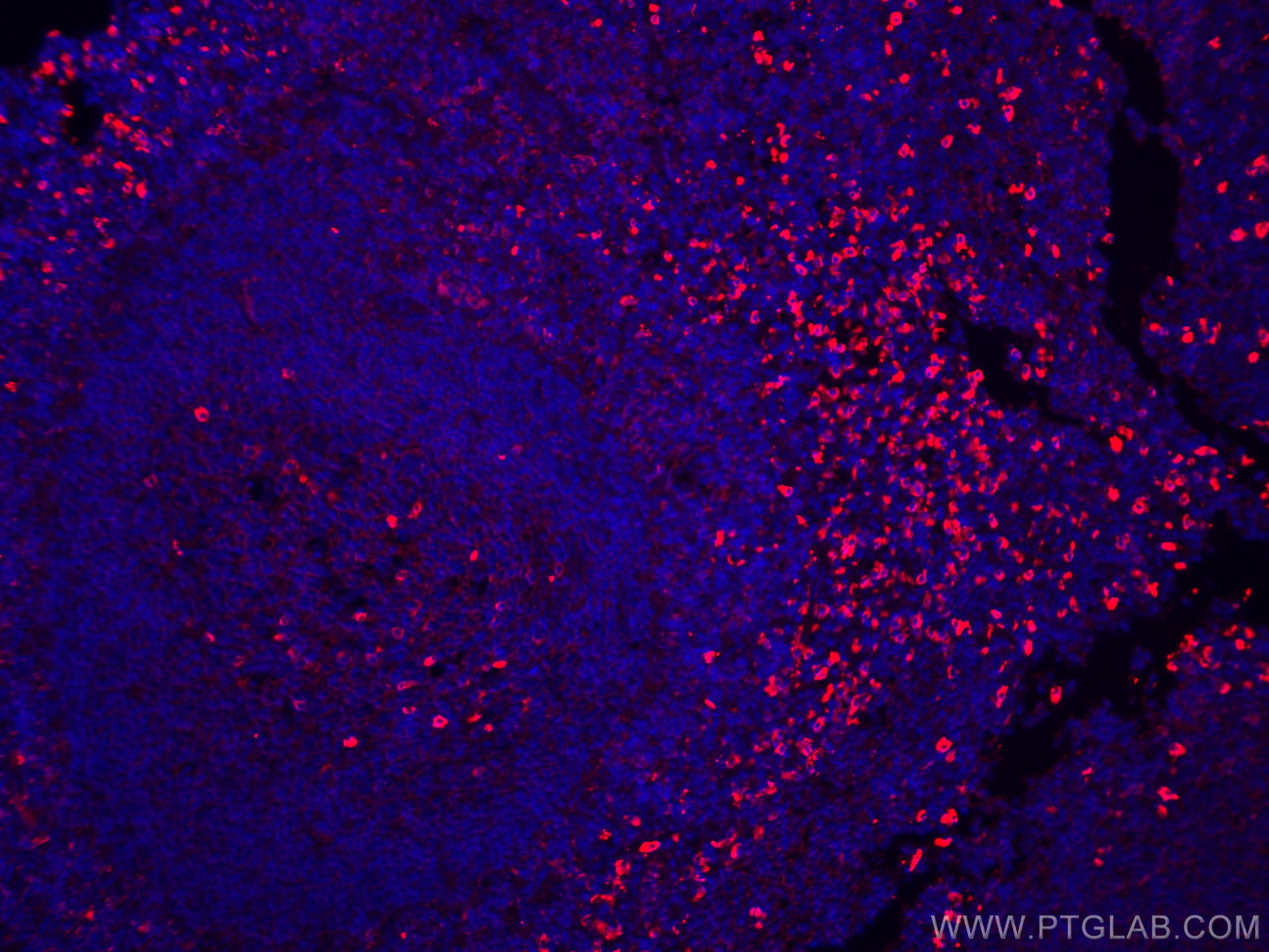 Immunofluorescence (IF) / fluorescent staining of human tonsillitis tissue using CoraLite®594-conjugated IgG Lambda Light Chain Pol (CL594-20758)