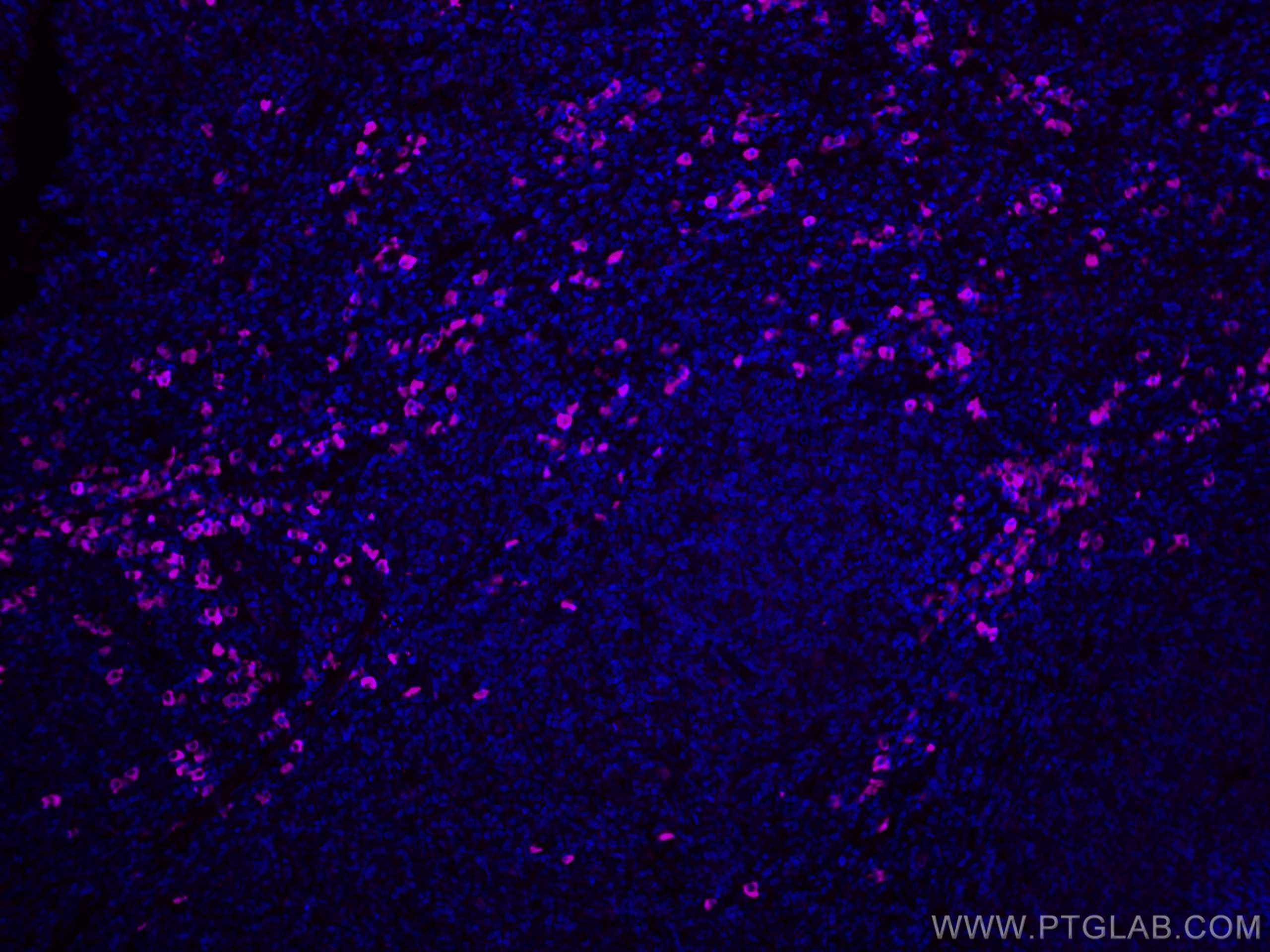 IF Staining of human tonsillitis using CL647-11541