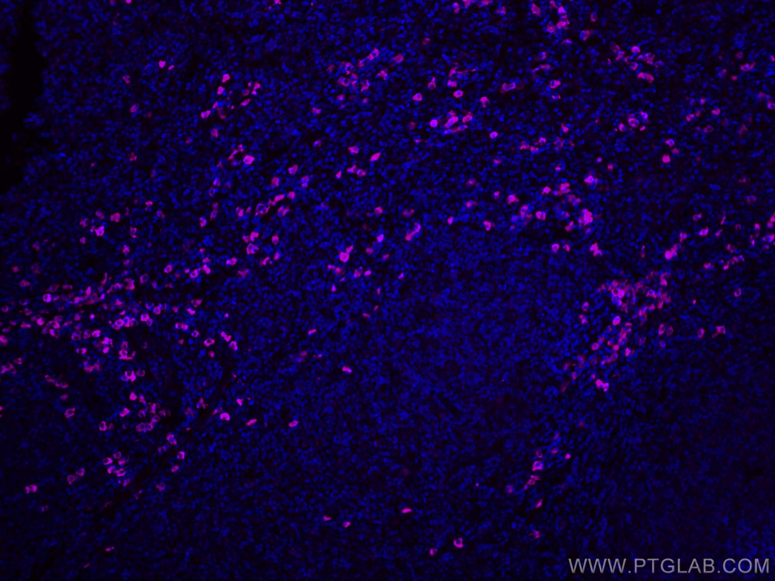 Immunofluorescence (IF) / fluorescent staining of human tonsillitis tissue using CoraLite® Plus 647-conjugated IgG Lambda Light Cha (CL647-11541)