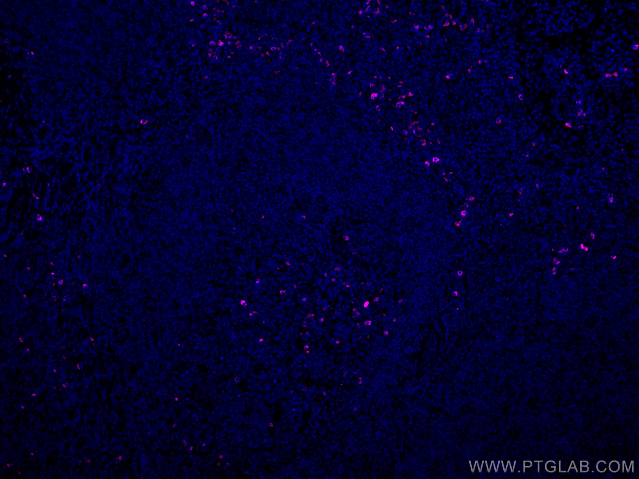 Immunofluorescence (IF) / fluorescent staining of human tonsillitis tissue using CoraLite® Plus 647-conjugated IgG Lambda Light Cha (CL647-20758)