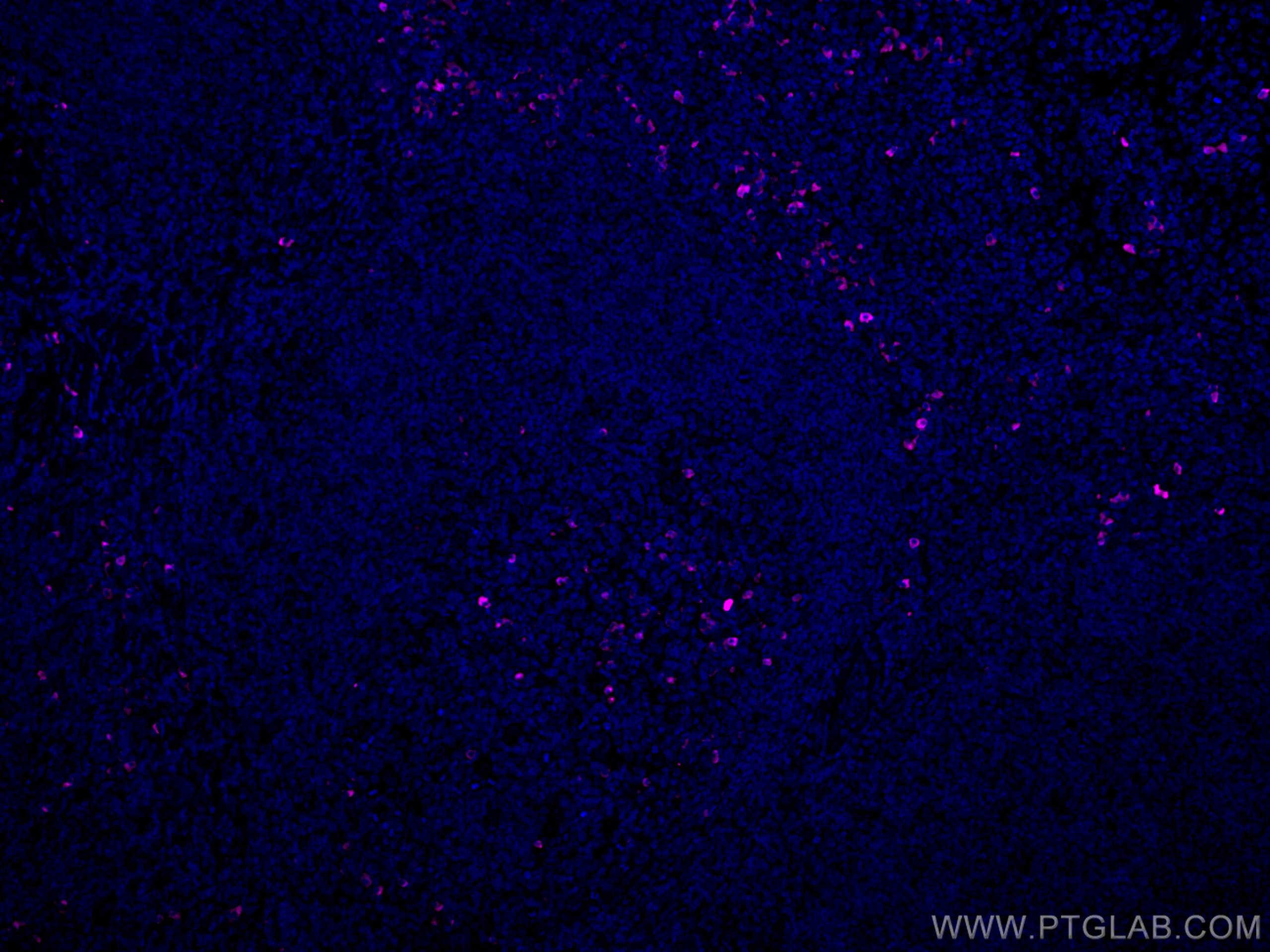 IF Staining of human tonsillitis using CL647-20758