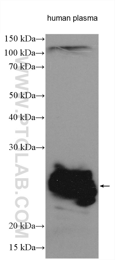 Western Blot (WB) analysis of various lysates using HRP-conjugated IgG Lambda Light Chain Polyclonal a (HRP-11541)