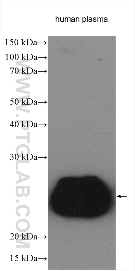 Western Blot (WB) analysis of various lysates using HRP-conjugated IgG Lambda Light Chain Polyclonal a (HRP-20758)