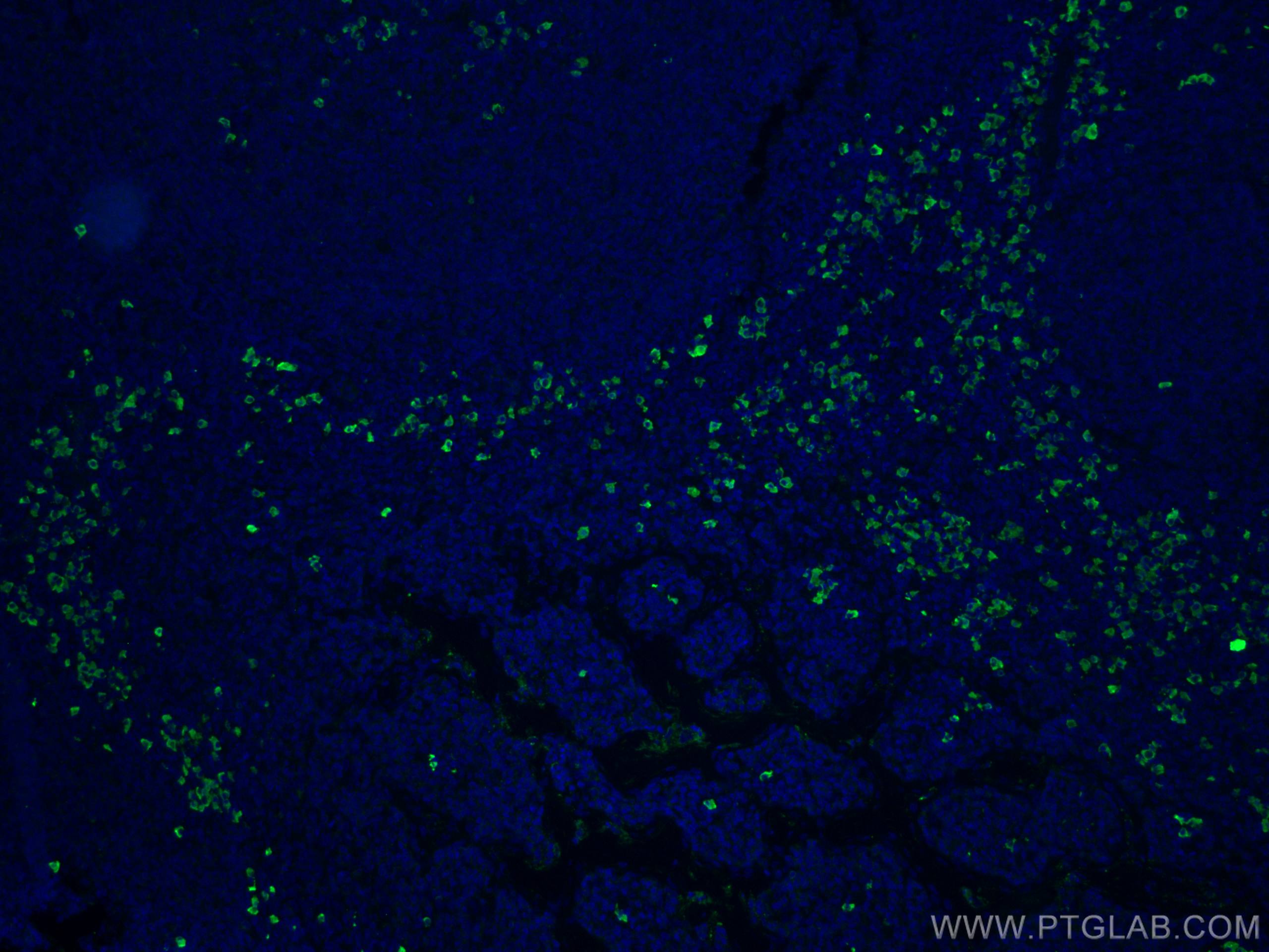 Immunofluorescence (IF) / fluorescent staining of human tonsillitis tissue using Human IgG Lambda Light Chain Polyclonal antibody (20758-1-AP)