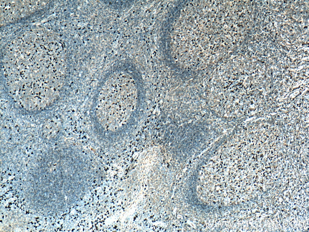 Immunohistochemistry (IHC) staining of human tonsillitis tissue using Human IgG Lambda Light Chain Polyclonal antibody (20758-1-AP)