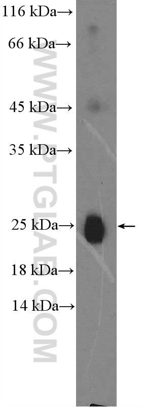 Western Blot (WB) analysis of human plasma using Human IgG Lambda Light Chain Polyclonal antibody (20758-1-AP)