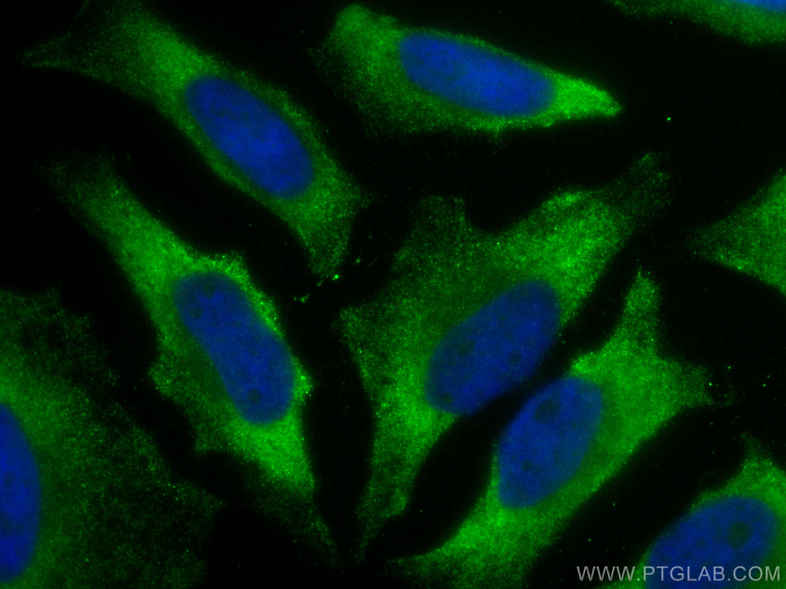 Immunofluorescence (IF) / fluorescent staining of HeLa cells using CoraLite® Plus 488-conjugated IkB Alpha Polyclonal (CL488-10268)