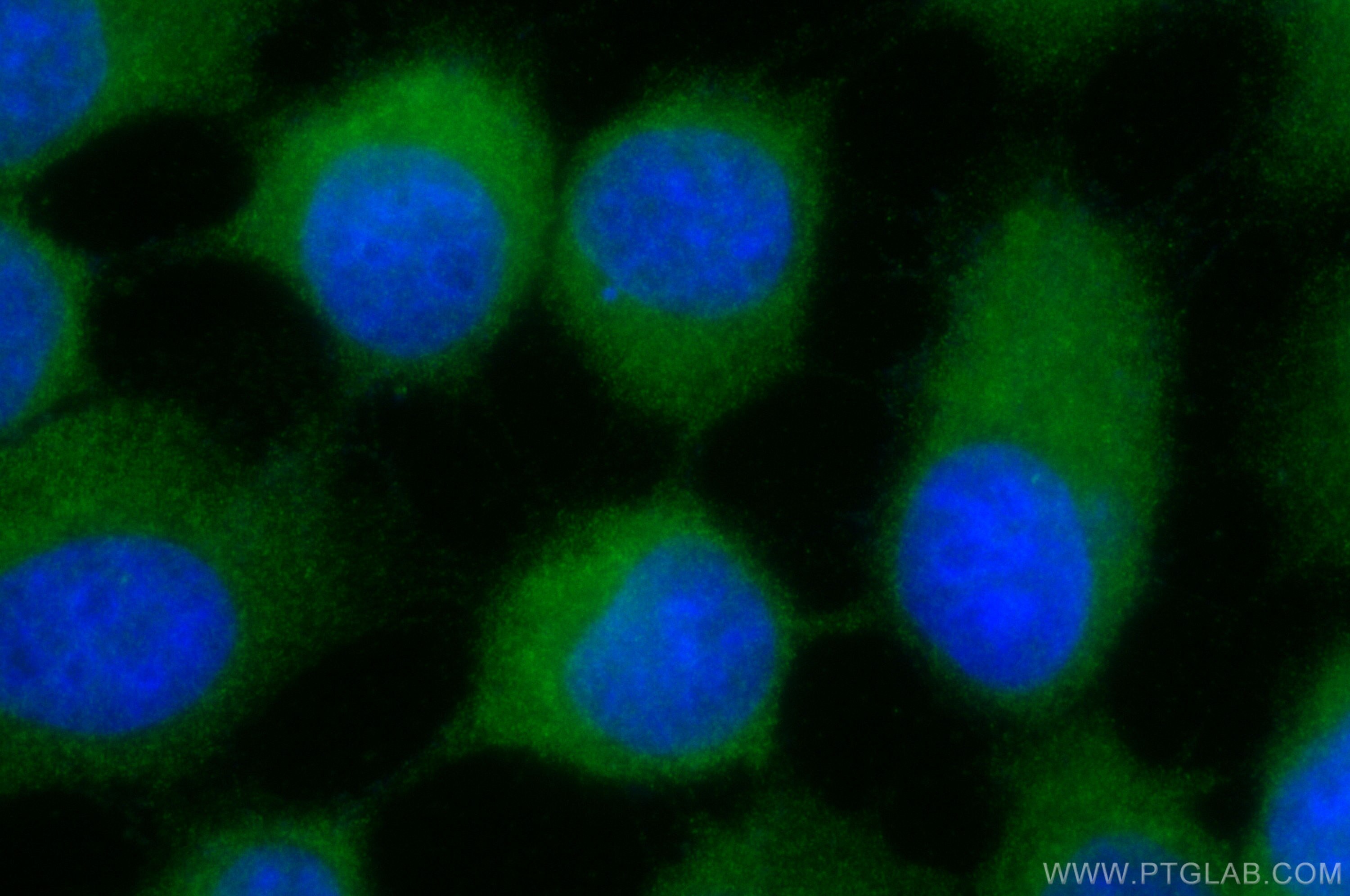 Immunofluorescence (IF) / fluorescent staining of A431 cells using CoraLite® Plus 488-conjugated IkB Alpha Polyclonal (CL488-10268)